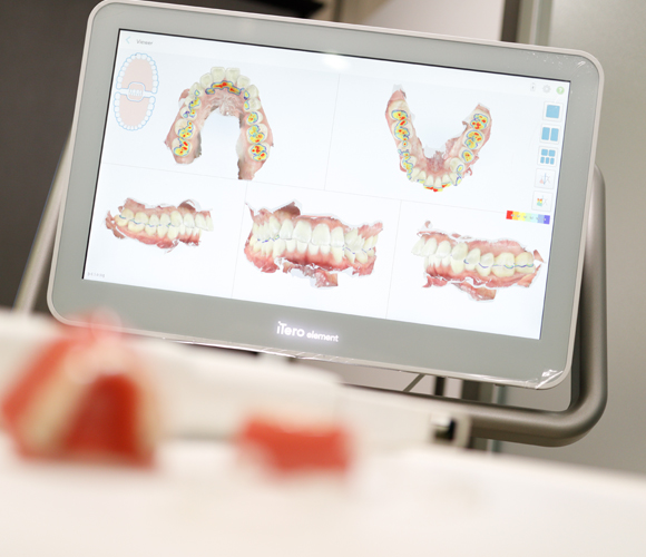 選ばれる理由03