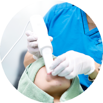 型取り時間を大幅に短縮